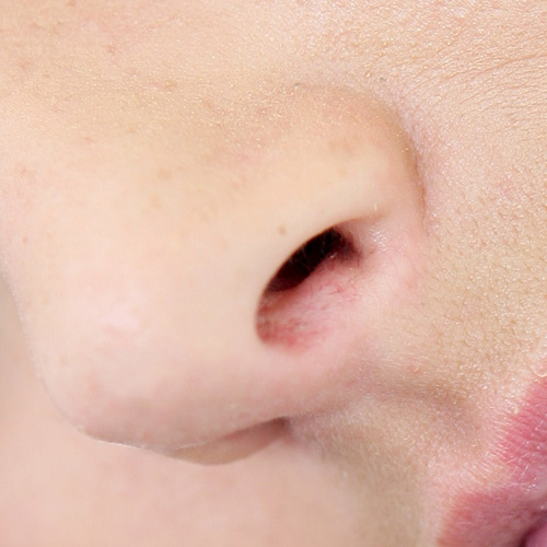 Body Parts answer: NOSTRIL