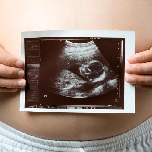 Parenting answer: ULTRASOUND